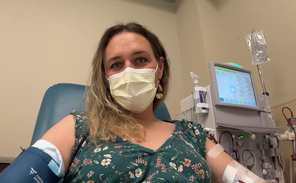 A woman with brown and blond hair, wearing a green floral dress and a yellow surgical mask. She has a blood pressure cuff on her right arm and tubing carrying her blood between her left arm and a dialysis machine.